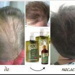 biorehab