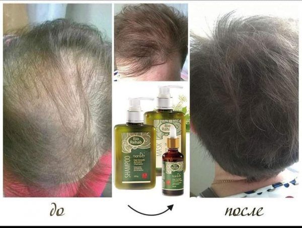 biorehab